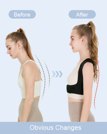 FHOCSLO Back Brace Posture Corrector Women and Men, Adjustable Shoulders Straightener - Breathable Upper Lower Back Support Belt Strap for Relieve Pain, Hunchback and Scoliosis (Nude, S)