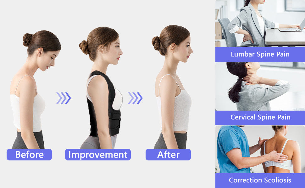 FHOCSLO Back Brace Posture Corrector Women and Men, Adjustable Shoulders Straightener - Breathable Upper Lower Back Support Belt Strap for Relieve Pain, Hunchback and Scoliosis (Nude, S)